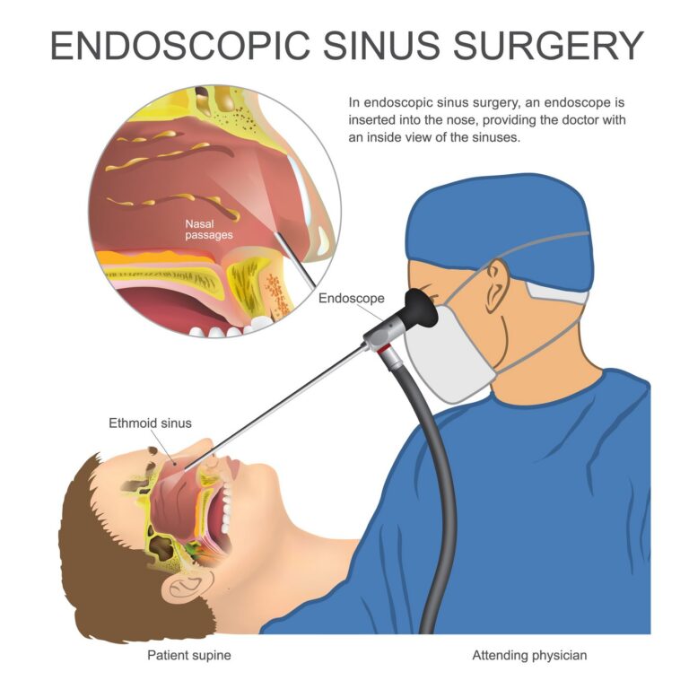 Rhinoplasty and nasal reconstruction