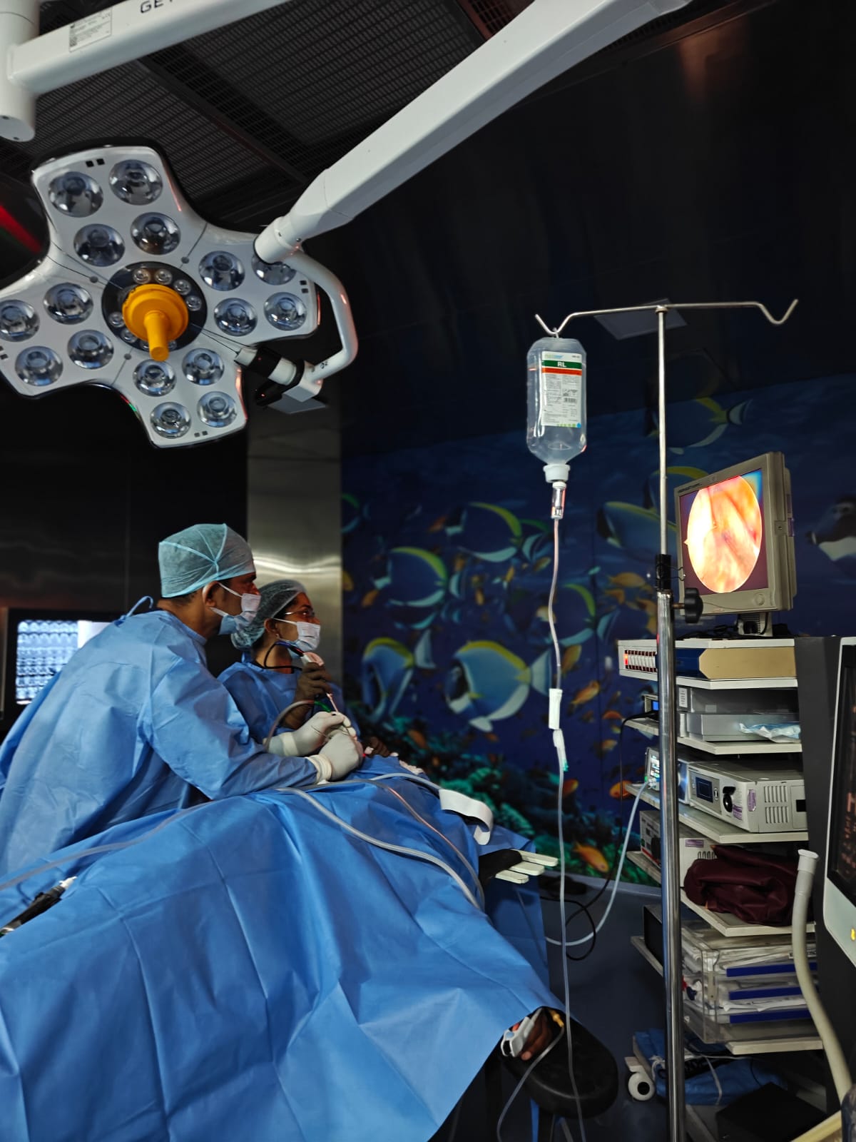 Close-up of coordinated instrument handling during four-hand endoscopic skull base surgery