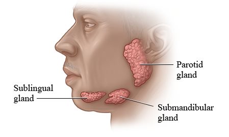 SUB MANDIBULAR SALIVARY GLAND EXCISION